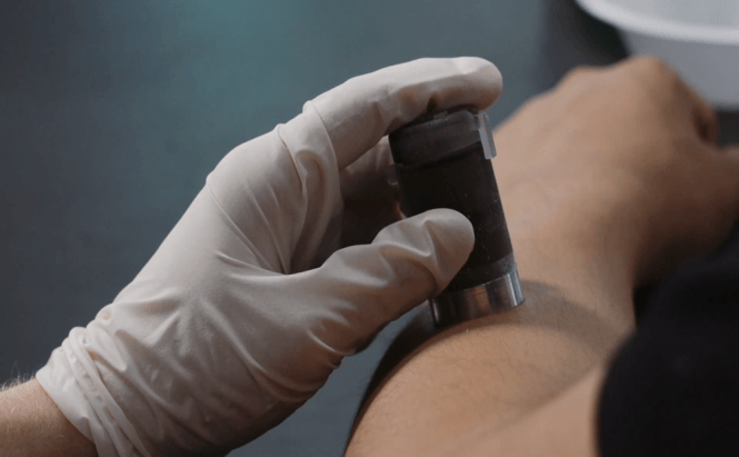 Project 'Comfortably Numb' May Have Made Injections Painless